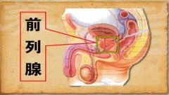 细菌前列腺炎怎么治疗？